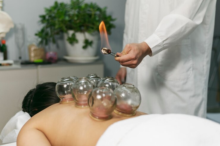 Unlocking The Benefits Of Acupuncture Therapist Clifton NJ